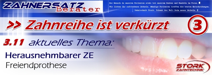 Eine Zahnreihe ist verkürzt